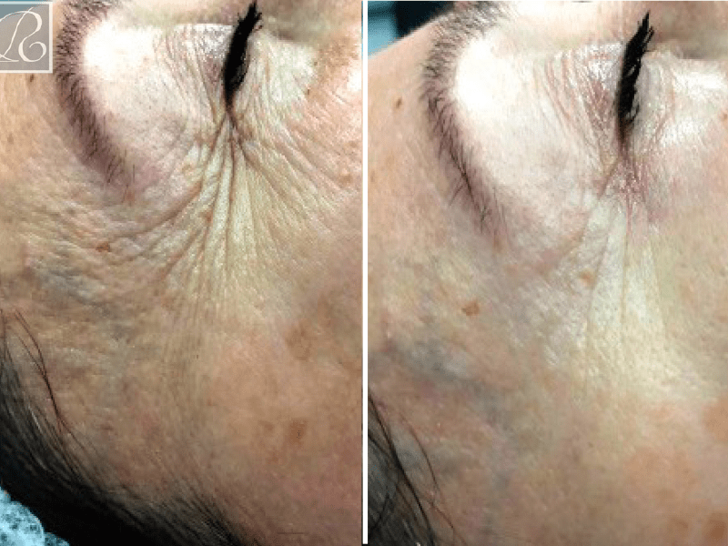 Преміум-догляд за шкірою навколо очей